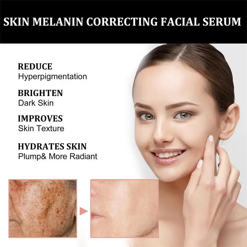 Serum perbaikan Wajah 30ml, hi - Vitamin C Serum Face ulasan dan harga