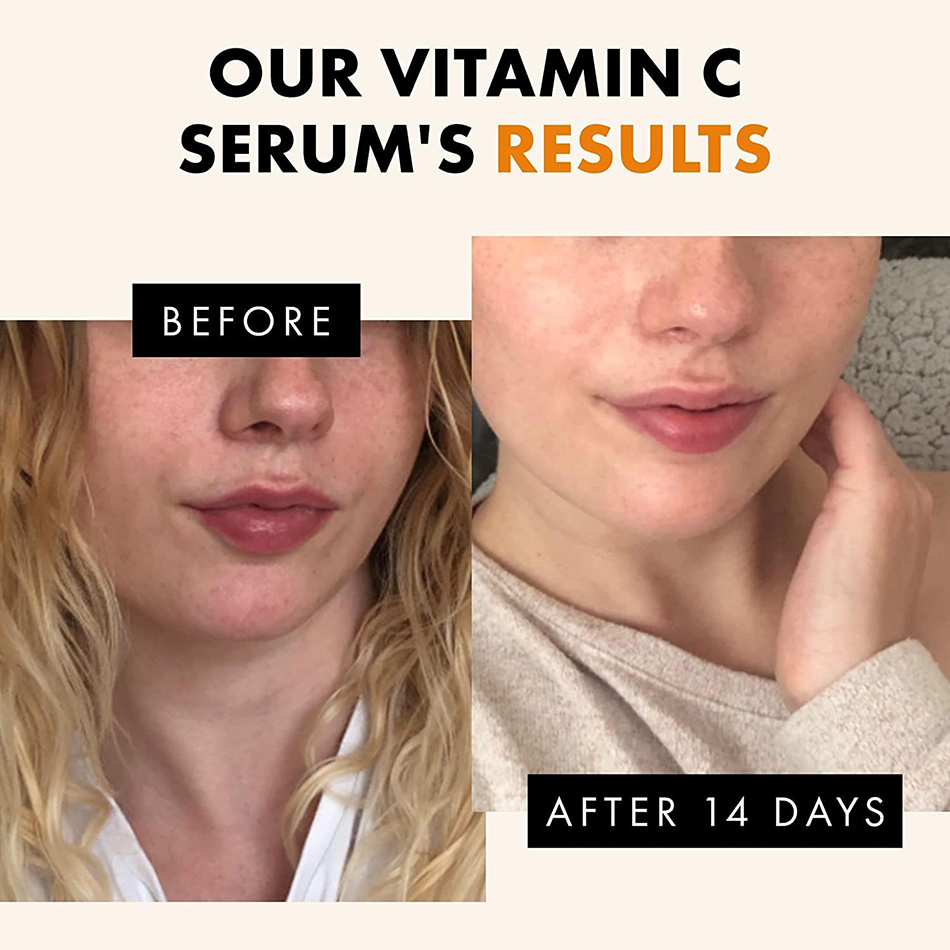 Serum Vitamin C Anti Penuaan 1 - Vitamin C Serum Face ulasan dan harga